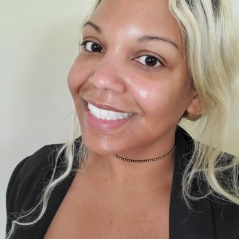 Dermalessence - Post chemical peel! - Skin Care Near Me - Fredericksburg, Virginia