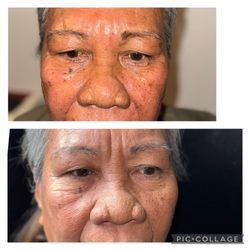 Radiantilyk Aesthetic - Collagen boosters.