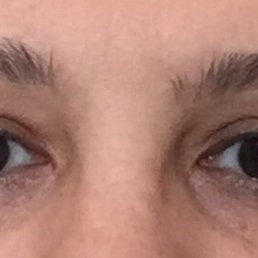 Before photo of brows