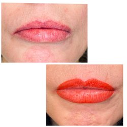 A Face Forever Permanent Cosmetic Specialist - Permanent lip color