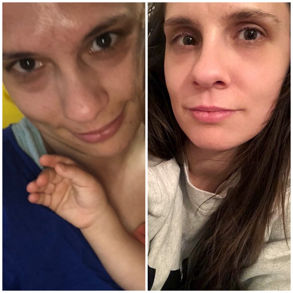 SINGHAL PLASTIC SURGERY Updated August 2024 9081 NE 81st Ter