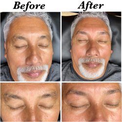 Beautify - Men's Grooming Special: Customized Eyebrow Shaping/Wax, Painless Nostril Wax, Ear Wax, Nose Strip/Wax (black/white head remover)