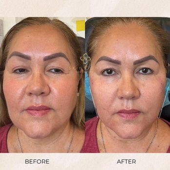 SkinTight Aesthetics - Skin Care Near Me - Los Angeles, California SkinTight Aesthetics - Skin Care Near Me - Los Angeles, California