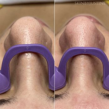 Skin by Justine - Skin Care Near Me - Valencia, California Skin by Justine - Skin Care Near Me - Valencia, California