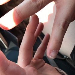 Nail Lite