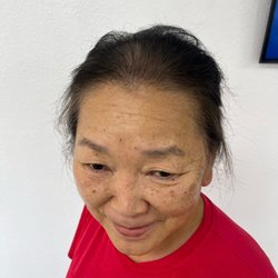 Client looking good after her density treatment
