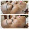 Soft Aesthetics SkinCare Clinic gift card