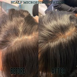 The Scalp Lab - Before and after two SMP session for this client 
[female client]