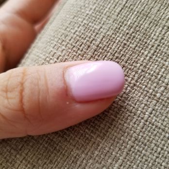Tulip Nails - My cut and infection after visiting this place. Nail color is pretty, not worth the infection. - Nail Salons Near Me - Alameda, California Tulip Nails - My cut and infection after visiting this place. Nail color is pretty, not worth the infection. - Nail Salons Near Me - Alameda, California