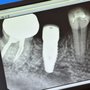 Photo of Colorado Oral Surgery Group
