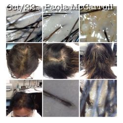 Trichology By Dahleen & PMU - Hair root obstruction