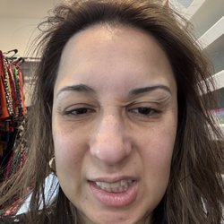 Sona Dermatology of Midlothian - Now (facial paralysis)