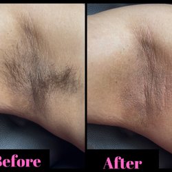 Bare Kitty Waxing