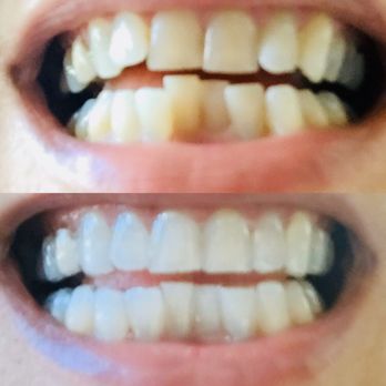 Kunik Orthodontics - Orthodontists Near Me - Austin, Texas
