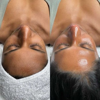 Touch Of Elegance N Valley - Schedule your facial with a complementary Scalp treatments - Massage Near Me - Phoenix, Arizona Touch Of Elegance N Valley - Schedule your facial with a complementary Scalp treatments - Massage Near Me - Phoenix, Arizona