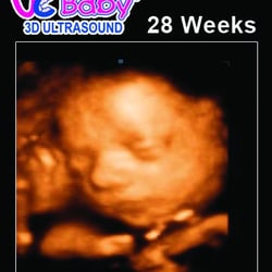 UC Baby Abbotsford