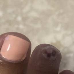 This is why my feet were burning while. I don't know what products were used. This is why my feet were burning while. I don't know what products were used.