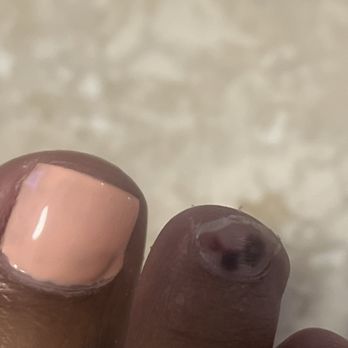 American Nail & Spa - This is why my feet were burning while. I don't know what products were used. - Nail Salons Near Me - Fontana, California