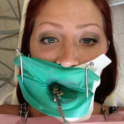 Getting my cavity filled