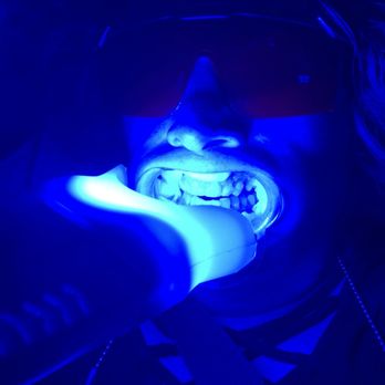 Smile Brite Teeth Whitening - Teeth Whitening Near Me - Sacramento, California