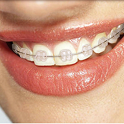 Anzilotti Orthodontics