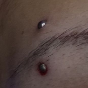 Redink Tattoo Studio - My eyebrow piercing that got embedded due to improper sizing :/ - Tattoo Near Me - New York, New York Redink Tattoo Studio - My eyebrow piercing that got embedded due to improper sizing :/ - Tattoo Near Me - New York, New York