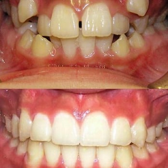 Shiuann-Rong Chen, DDS - Copyright (c) 2013 Chen-Cabri Orhodontics. All rights reserved. - Orthodontists Near Me - Flushing, New York