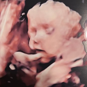 Baby's First Photos - Baby boy #2 - Diagnostic Imaging Near Me - Bakersfield, California