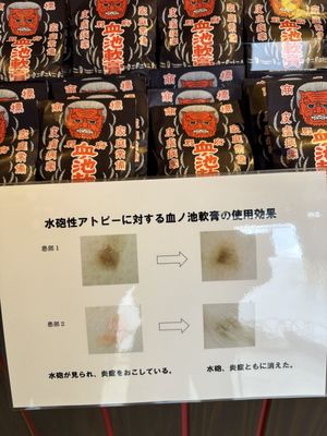 Chinoike Jigoku by null