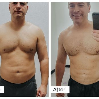 BelleSculpt - Body Contouring Near Me - Tulsa, Oklahoma