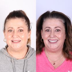 Illume Dental of McKinney