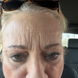 Mirage Medical Spa - Only 8 weeks after treatments poor results. Like a larger refund than $250. Paid $3300  owner Emma wants to give me more treatments instead.