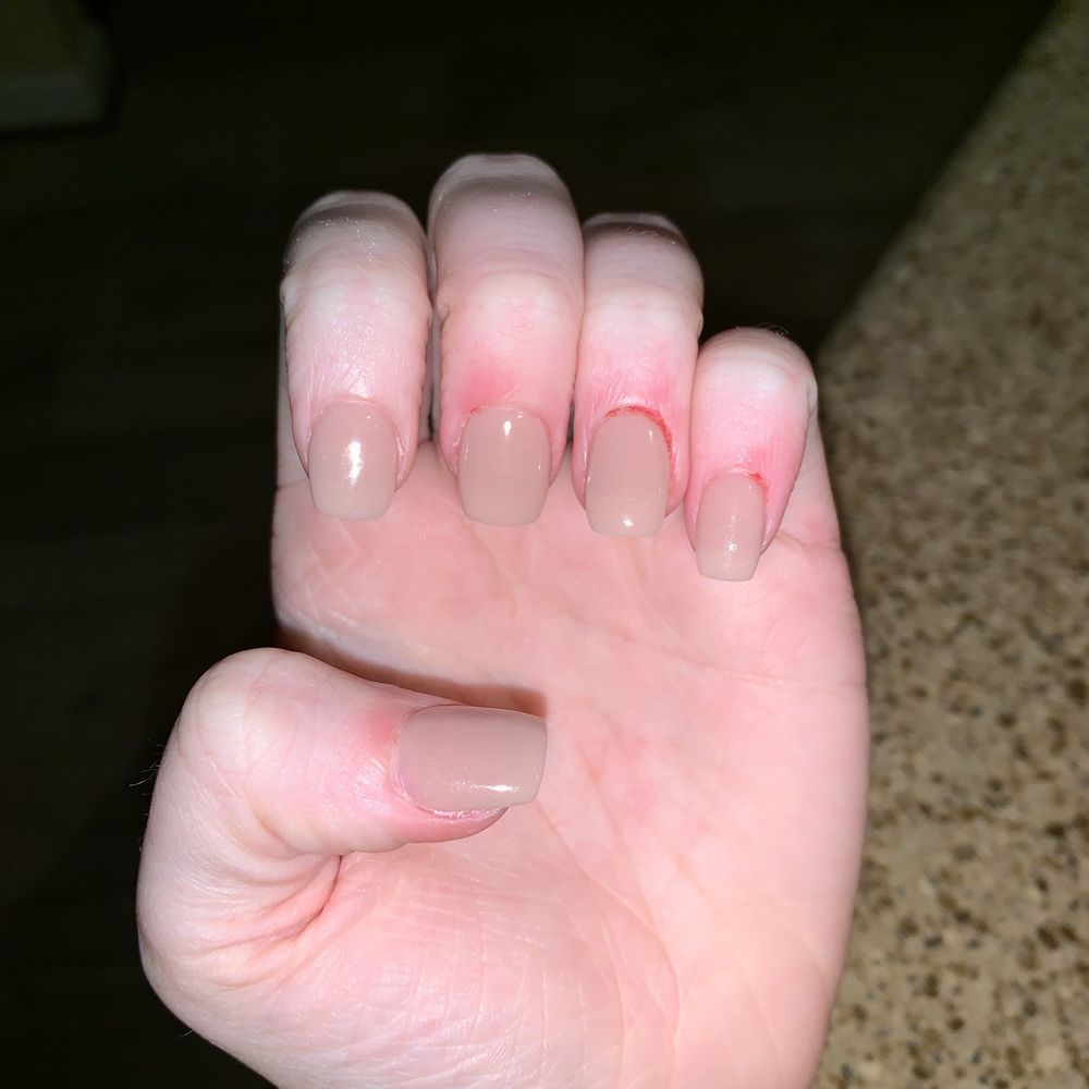 Square shape, blood around my cuticles.
