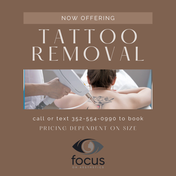 Focus on Aesthetics - Now offering Tattoo Removal. Our laser makes saying goodbye that much faster, less painless, effective, and easier. - Laser Hair Removal Near Me - Gainesville, Florida Focus on Aesthetics - Now offering Tattoo Removal. Our laser makes saying goodbye that much faster, less painless, effective, and easier. - Laser Hair Removal Near Me - Gainesville, Florida