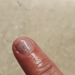 Fancy Nails - Red and hurting bad!!!