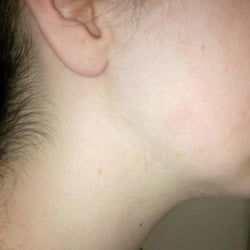 Jabulani Kosmetic Laser Spa