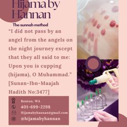 Hijama By Hannan