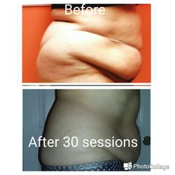 AquaVita Med Spa - Body Molding Contour