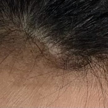 IBMC College Longmont - My forehead and scalp are covered with dye that I can't get off - Colleges & Universities Near Me - Longmont, Colorado IBMC College Longmont - My forehead and scalp are covered with dye that I can't get off - Colleges & Universities Near Me - Longmont, Colorado