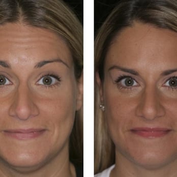 Rao Dermatology - Dermatologists Near Me - Edmonton, Alberta Rao Dermatology - Dermatologists Near Me - Edmonton, Alberta