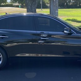20% front and 5% back. Looks great.  Very happy!!!