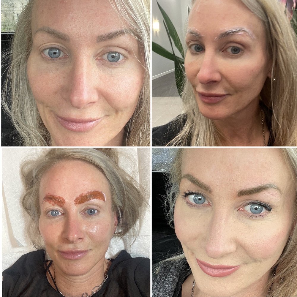 Illuminated Skincare - 1, before 2, numbing 3, removing faded micro pigment from years of fading 4 my glamorous ending results - Skin Care Near Me - Rocklin, California Illuminated Skincare - 1, before 2, numbing 3, removing faded micro pigment from years of fading 4 my glamorous ending results - Skin Care Near Me - Rocklin, California