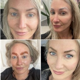 1, before 2, numbing 3, removing faded micro pigment from years of fading 4 my glamorous ending results