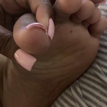 Luxe Nail Salon - Thick acrylic on toe (front view) - Nail Salons Near Me - Hayward, California