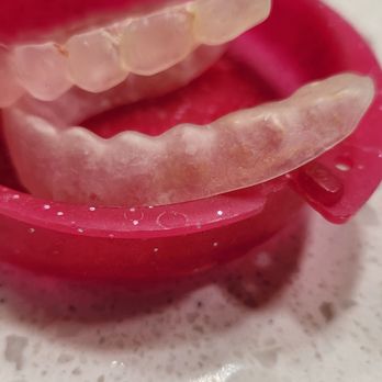 Greenberg Orthodontics & TMJ - Comparison of the poor lower imprint versus the more detailed imprint of the top retainers - Oral Surgeons Near Me - Altadena, California Greenberg Orthodontics & TMJ - Comparison of the poor lower imprint versus the more detailed imprint of the top retainers - Oral Surgeons Near Me - Altadena, California