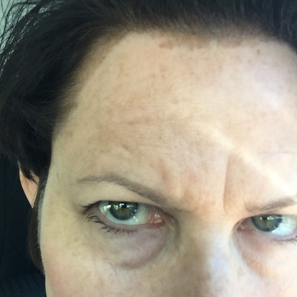 I'm furious that the stylist didn't protect my skin before applying hair color!!!! I'm furious that the stylist didn't protect my skin before applying hair color!!!!