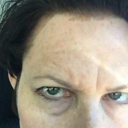 I'm furious that the stylist didn't protect my skin before applying hair color!!!! I'm furious that the stylist didn't protect my skin before applying hair color!!!!