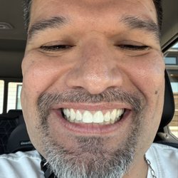Apex Dental - Me Cheesn with the new grill!