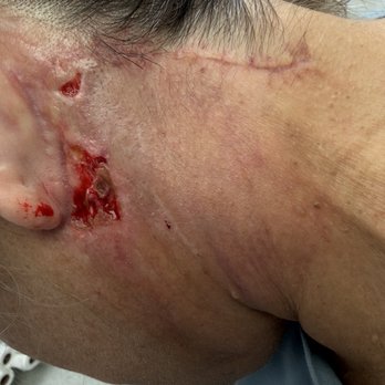 Carlos Spera, MD - 2 meses - Cosmetic Surgeons Near Me - Miami, Florida