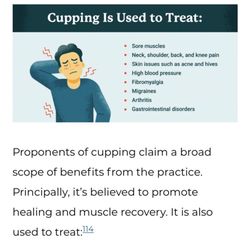 Relax Spa - Cupping Therapy explained